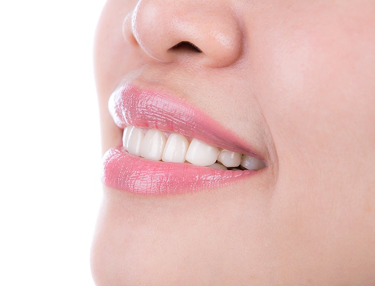 Closeup of a bright white smile as an example of Grove Dentistry's Bioclear services