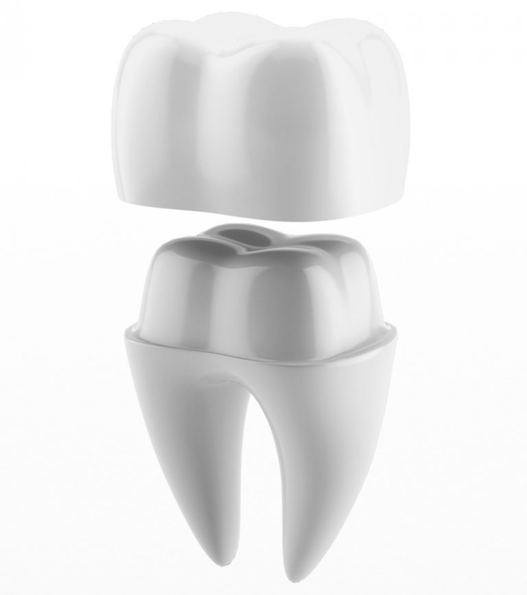 Dental Crowns Procedure Details & FAQ Dentistry at The Grove Dental Crowns Procedure Details & FAQ Dentistry at The Grove