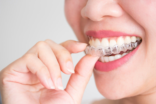 Smiling women holding Invisalign - Dentistry at The Grove
