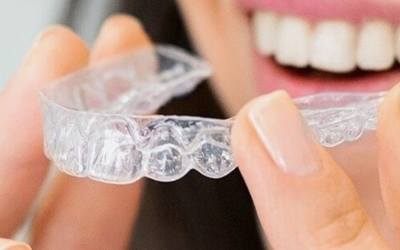 How to Stop Teeth Grinding with Night Guards